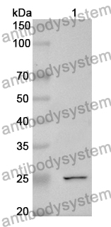 Anti-CCN1 Polyclonal Antibody