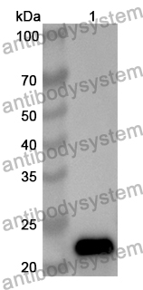 Anti-Human E2F3 Polyclonal Antibody