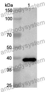 Anti-Human CES2 Polyclonal Antibody