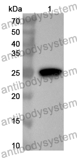 Anti-FBP2 Polyclonal Antibody