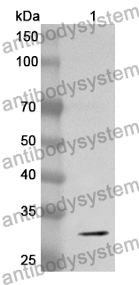 Anti-PDXK Polyclonal Antibody