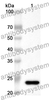 Anti-SOCS2 Polyclonal Antibody