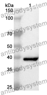 Anti-CDK2AP1 Polyclonal Antibody