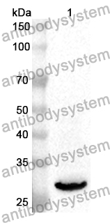 Anti-SOCS3 Polyclonal Antibody