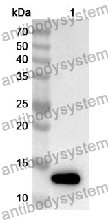 Anti-Human COX7A2L Polyclonal Antibody