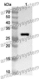 Anti-CCS Polyclonal Antibody