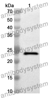 Anti-DVL1 Polyclonal Antibody