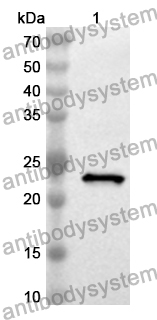 Anti-DVL2 Polyclonal Antibody