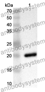 Anti-Human CHD1 Polyclonal Antibody