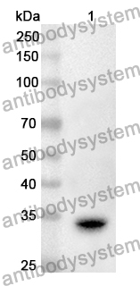 Anti-CD156c/ADAM10 Polyclonal Antibody