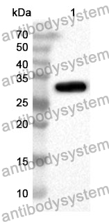 Anti-ABCD4 Polyclonal Antibody