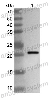 Anti-Human KMT2D Polyclonal Antibody