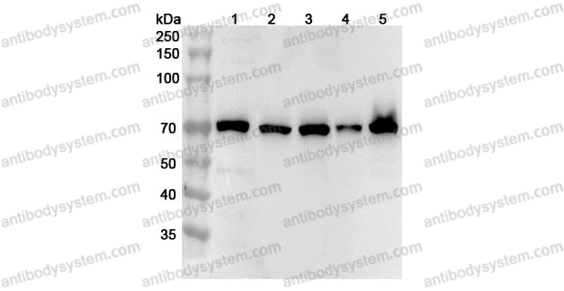 Anti-Human RIOK3 Polyclonal Antibody