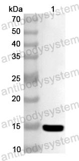 Anti-Human SLC9A3R1 Polyclonal Antibody