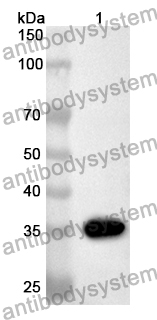 Anti-Human GNB5 Polyclonal Antibody