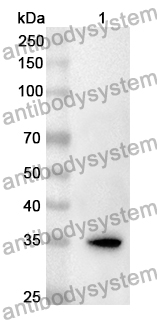 Anti-CD304/NRP1 Polyclonal Antibody