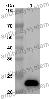 Anti-Human SH2D1B Polyclonal Antibody