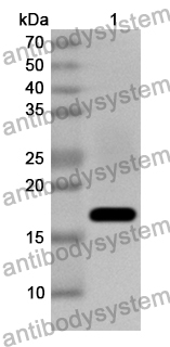 Anti-CPLX1 Polyclonal Antibody