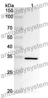 Anti-Human PHYH Polyclonal Antibody