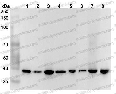 Anti-Human GIPC1 Polyclonal Antibody