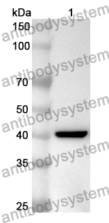 Anti-Human IKBKB Polyclonal Antibody