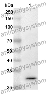 Anti-FSCN2 Polyclonal Antibody