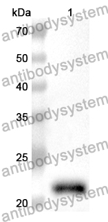 Anti-MYL12B Polyclonal Antibody