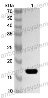 Anti-Human LECT2 Polyclonal Antibody