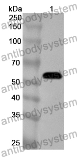 Anti-Human CLGN/Calmegin Polyclonal Antibody