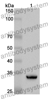 Anti-AZIN1 Polyclonal Antibody