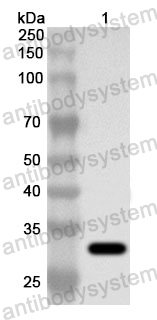 Anti-Human ATP2A1 Polyclonal Antibody