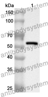 Anti-SEMA3E Polyclonal Antibody