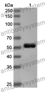 Anti-Human KDM6B Polyclonal Antibody