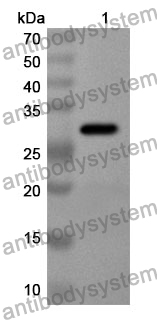 Anti-DCLK1 Polyclonal Antibody