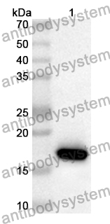 Anti-Human CEP290 Polyclonal Antibody