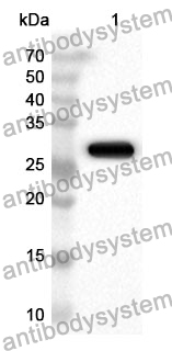 Anti-NPC1 Polyclonal Antibody