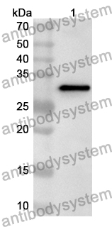 Anti-NPC1 Polyclonal Antibody