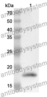 Anti-ANGPT2 Polyclonal Antibody