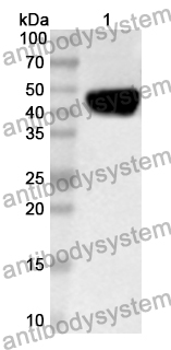 Anti-Human ARPC1B Polyclonal Antibody