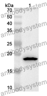 Anti-Human ARPC3 Polyclonal Antibody