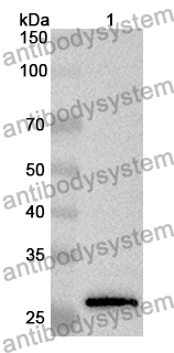 Anti-AXIN1 Polyclonal Antibody