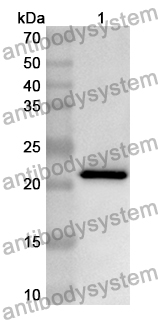 Anti-CETN3 Polyclonal Antibody