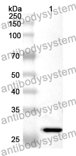 Anti-CTDSPL Polyclonal Antibody