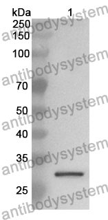 Anti-GSTA4 Polyclonal Antibody