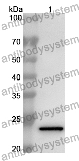 Anti-Human LAMA5 Polyclonal Antibody