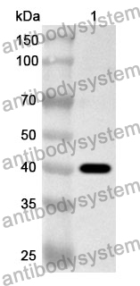 Anti-Human SPTLC2 Polyclonal Antibody