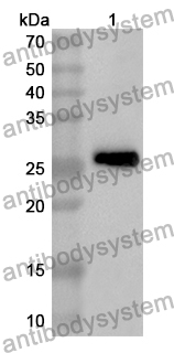 Anti-ALOX15B Polyclonal Antibody