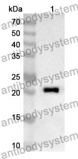 Anti-Human SIVA1 Polyclonal Antibody