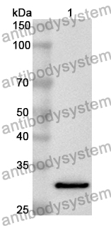 Anti-Human PMM2 Polyclonal Antibody