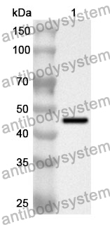 Anti-Human EIF3D Polyclonal Antibody